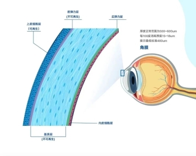 长期佩戴角膜塑形镜以后能做近视手术吗？北京爱尔英智眼科唐琰为您解答