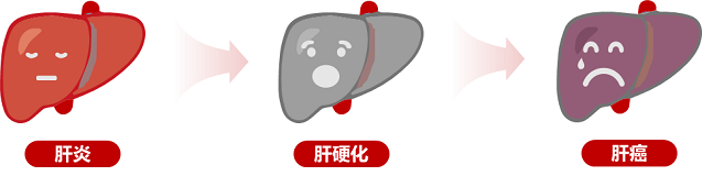 世界肝炎日：从乙肝到肝癌有多远？现代医学正在改写结局