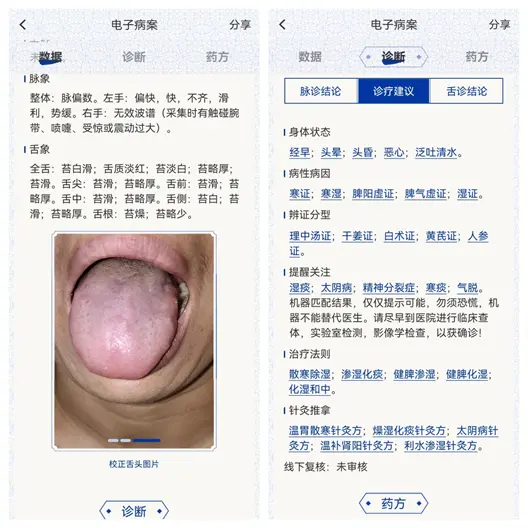 水针松解携手中医AI，湖北医疗团队为疑难运动障碍诊疗提供新路径