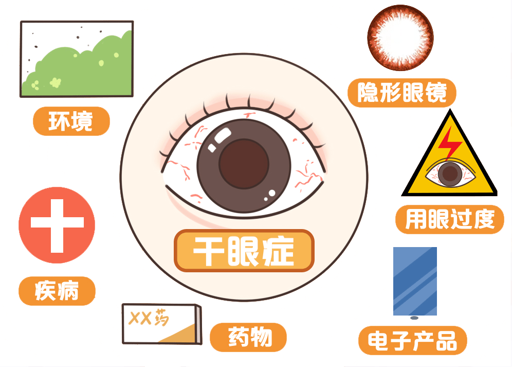 尖峰眼科医院怎么样 10月10日干眼关爱日