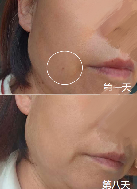 楚南承谷胱甘肽石斛片重磅出击，缓解熬夜肌肝负担