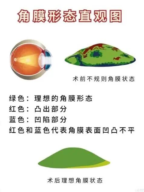 如何拥有像“鹰鸮”一样的出色夜视力！尖峰有高招！