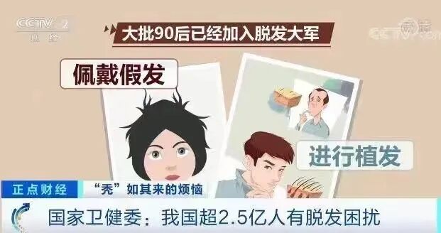 不想输在“发际线”!选对方法也能get高颅顶!杏林植发 不想输在“发际线”!选对方法也能get高颅顶!杏林植发