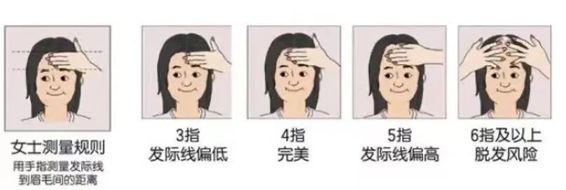 不想输在“发际线”!选对方法也能get高颅顶!杏林植发 不想输在“发际线”!选对方法也能get高颅顶!杏林植发