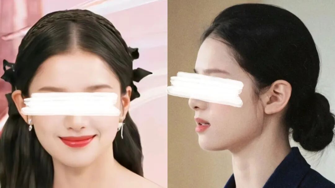 不想输在“发际线”!选对方法也能get高颅顶!杏林植发