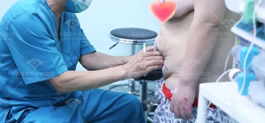 产后难收“游泳圈”？做好这件事，腰腹紧致！杏林吸脂