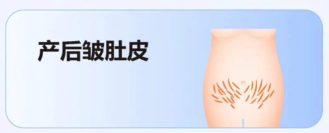 产后肚子大有3种类型?杏林腹壁整形术 产后肚子大有3种类型?杏林腹壁整形术