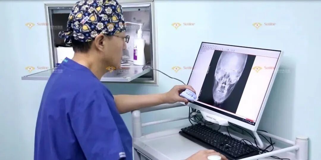 6种嘴凸表现，你是哪一种？杏林改脸型